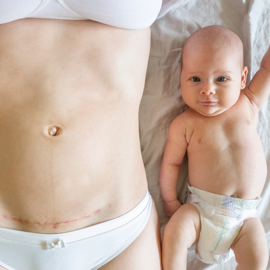 How long should I wear a binder after a C-section?